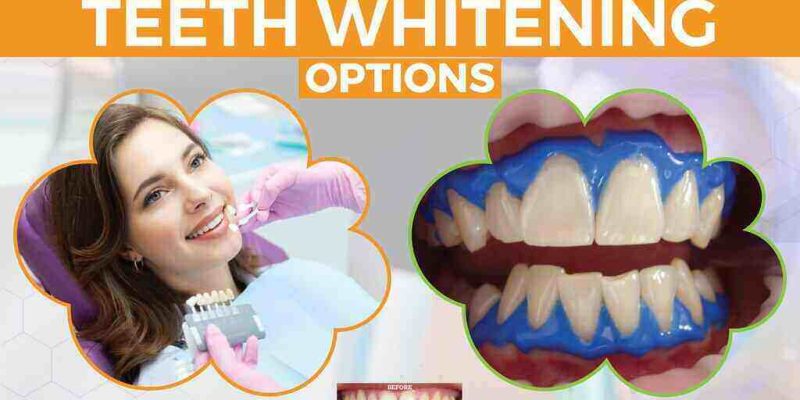 Elephant Dental Services – Meru