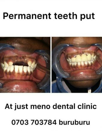 JUST MENO Dental Clinic