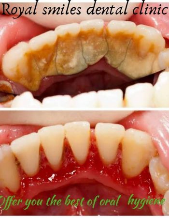 Royal Smiles Dental Clinic – Ruaka