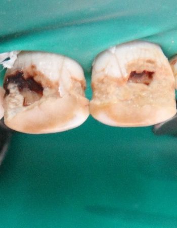 Ivory dental care