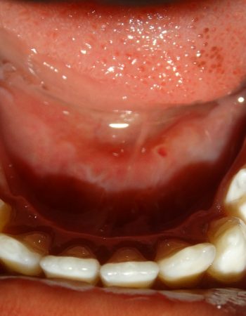 Ivory dental care