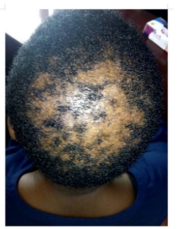 Nairobi Hair Restoration And Aesthetic Clinic