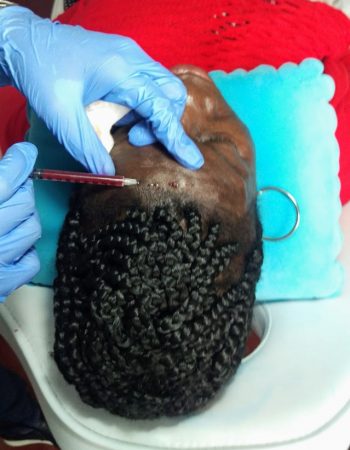 Nairobi Hair Restoration And Aesthetic Clinic
