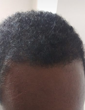 Nairobi Hair Restoration And Aesthetic Clinic