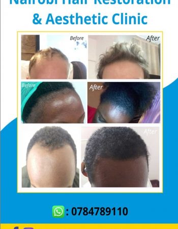 Nairobi Hair Restoration And Aesthetic Clinic